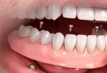 Cовременные технологии протезирования зубов