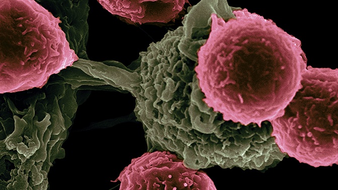 Ученые нашли способ определить эффективность лечения рака