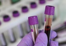 В Челябинской области скончались 6 пациентов с коронавирусом