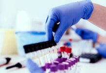 В Челябинской области за сутки коронавирусом заразились 170 человек