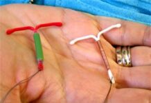 Когда лучше устанавливать ВМС?