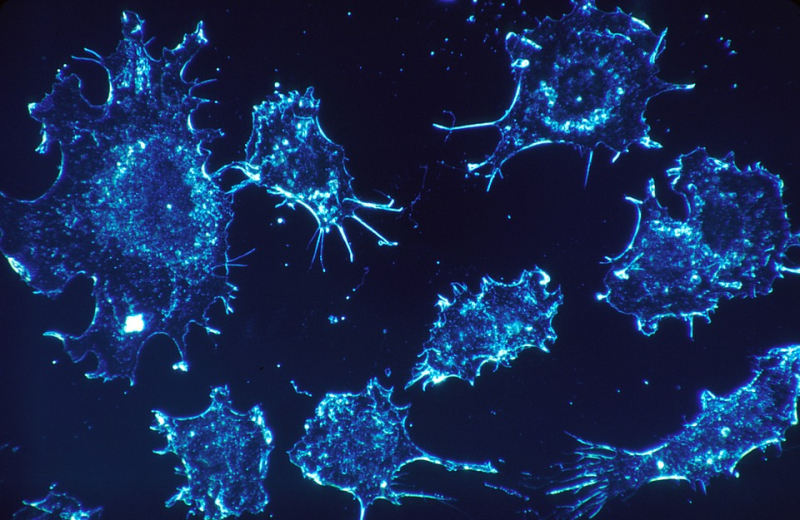 В ВОЗ спрогнозировали исчезновение трех видов рака в ближайшие десятилетия