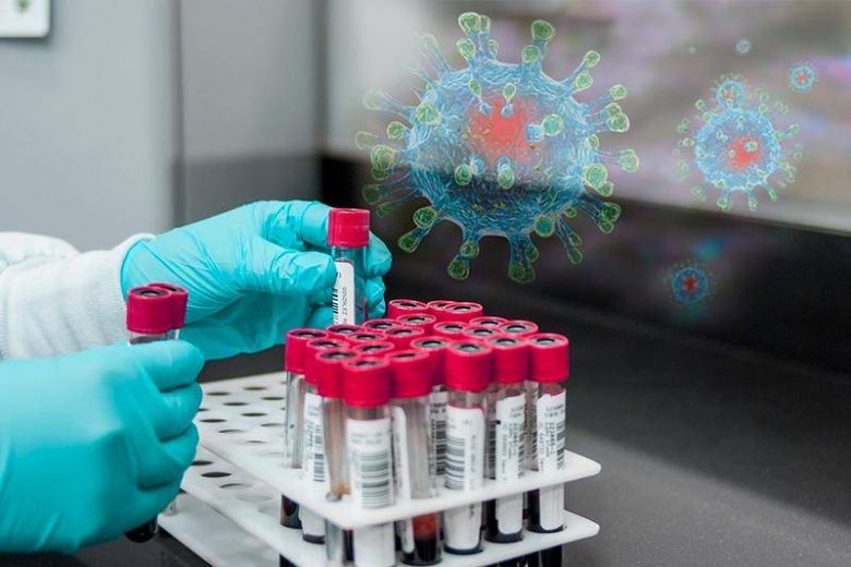 <br />
Новый штамм коронавируса обнаружили в США, предполагаемая смертность может достигать 82%                
