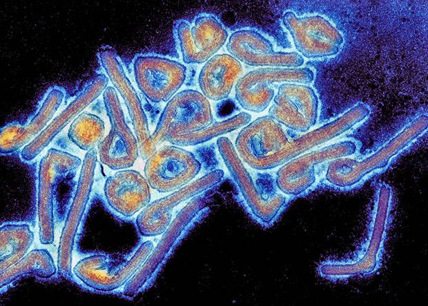<br />
Заразный вирус Марбург начал убивать: первый случай зафиксирован в Африке                