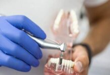 Как подготовиться к имплантации зубов ?