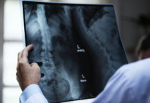 Девушка с дефектом позвоночника выиграла суд против врача, который позволил ей родиться