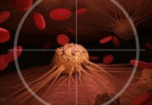 Рак: особенности заболевания и его лечение