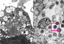 Учёные раскрыли полный механизм потери обоняния при коронавирусе: как это происходит?