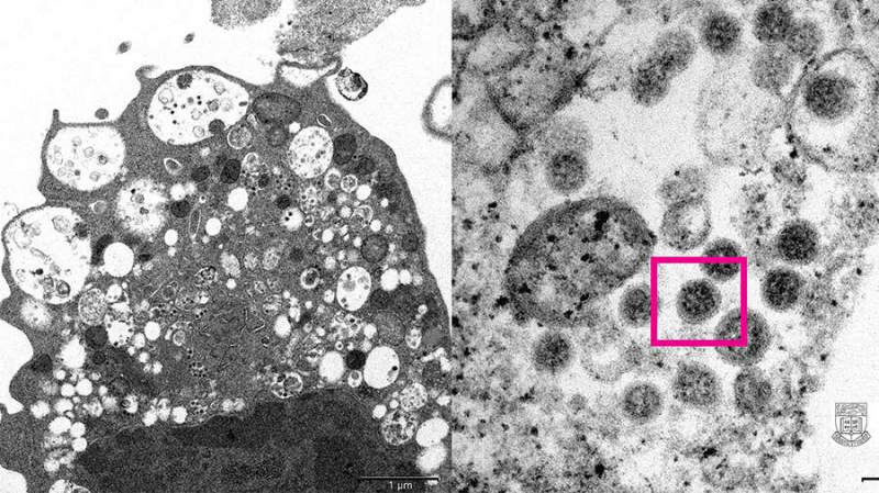 Учёные раскрыли полный механизм потери обоняния при коронавирусе: как это происходит?