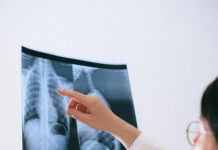 Диагностика коронавируса без ПЦР: как можно диагностировать заболевание с помощью рентгена
