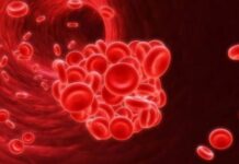 Ранние признаки тромбоза: какие сигналы подает организм при образовании тромбов