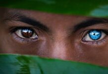 Россиянам рассказали, как по глазам определить диабет и болезни печени