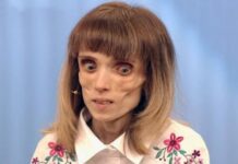 Страдающая анорексией Кристина Корягина идет на поправку