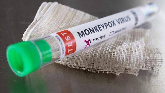 <br />
Вспышка обезьяньей оспы: ученые назвали неожиданную причину вируса                