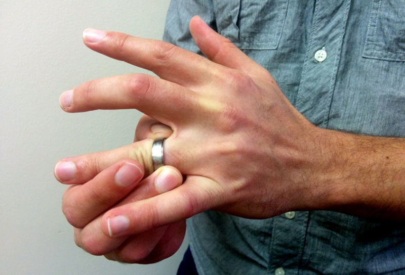 <br />
Как быстро и безопасно самостоятельно снять кольцо с опухшего пальца                