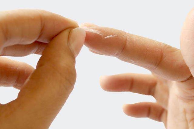 <br />
Как удалить суперклей с пальцев: пять лучших советов                