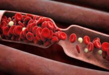 Почему врачи запрещают пациентам самовольно принимать препараты, разжижающие кровь