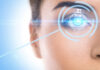 Виды лазерной коррекции зрения