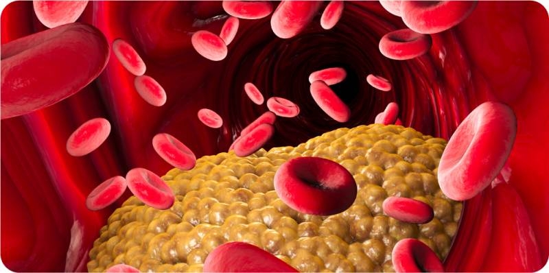 <br />
Специалисты разъяснили, как часто нужно сдавать кровь на холестерин                