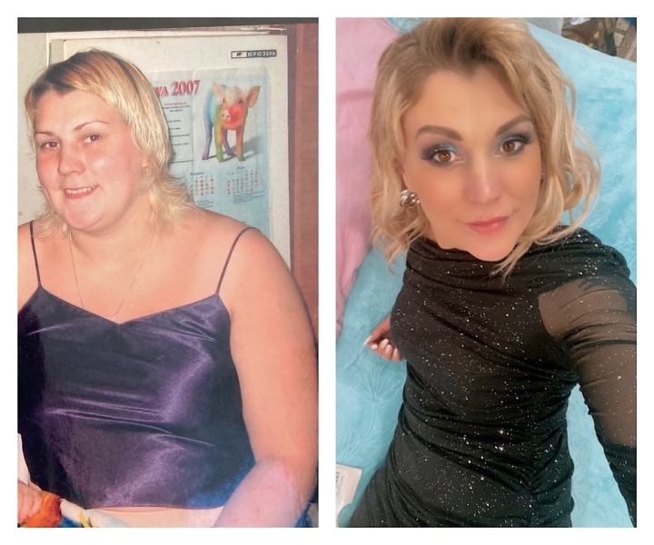 Жительница Челябинской области потеряла способность ходить в 18 лет, похудела на 50 килограммов и стала мамой