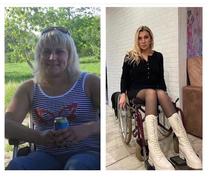 Жительница Челябинской области потеряла способность ходить в 18 лет, похудела на 50 килограммов и стала мамой