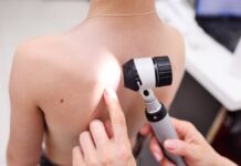 Что представляет собой дерматоскопия?