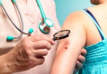 Что важно знать о меланоме: ключевые факты о заболевании