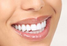 Профессиональная чистка зубов в стоматологии Smile