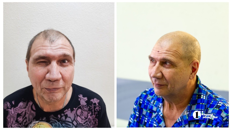 Житель Челябинска семь лет страдал от нервных тиков и судорог глаза