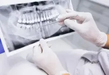 Рентген зубов в современной стоматологической клинике