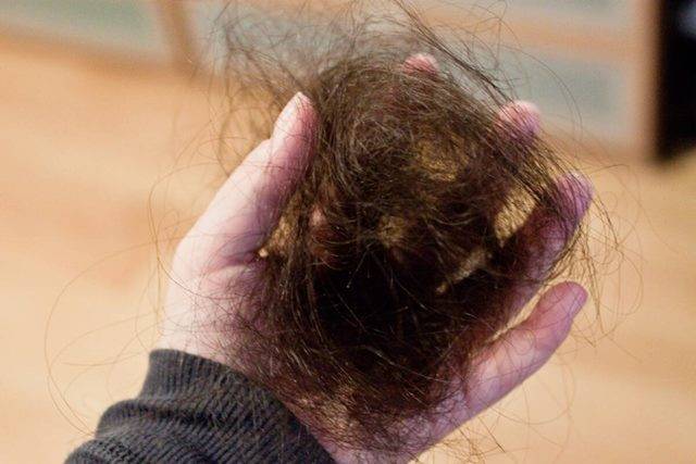 <br />
Игры подсознания или реальная угроза: к чему снится выпадение волос                